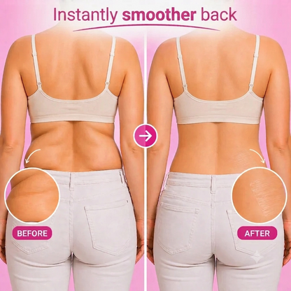 Relaxion™ Instant Contour Tapes